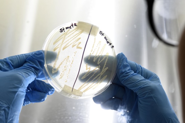 Con la Nanotecnología como aliada, científicos de la UNLP luchan contra infecciones bacterianas graves